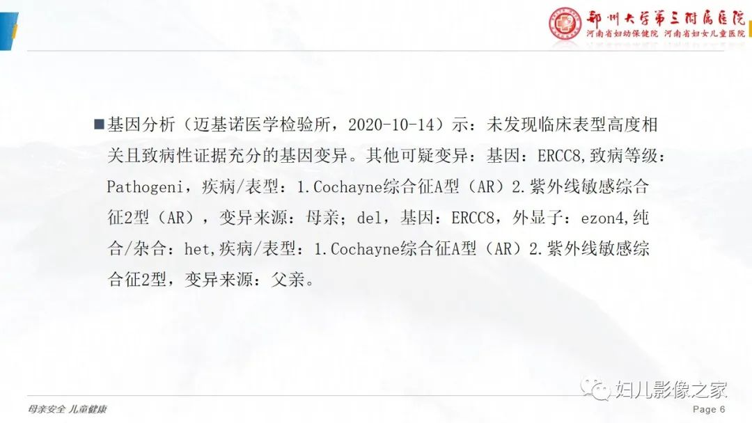 影像PPT - 【病例】cockayne综合征1例影像诊断-6