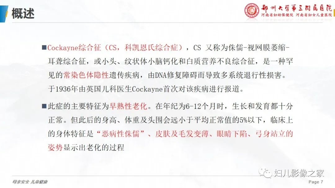 影像PPT - 【病例】cockayne综合征1例影像诊断-7