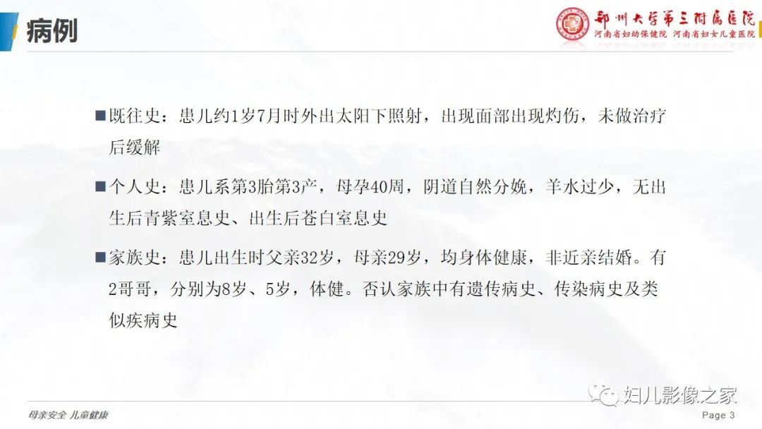 影像PPT - 【病例】cockayne综合征1例影像诊断-3