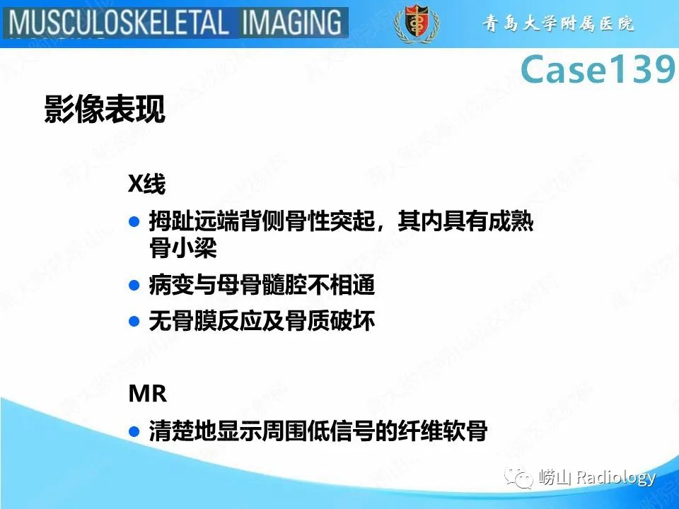 影像PPT - 【PPT】甲下外生性骨疣-16