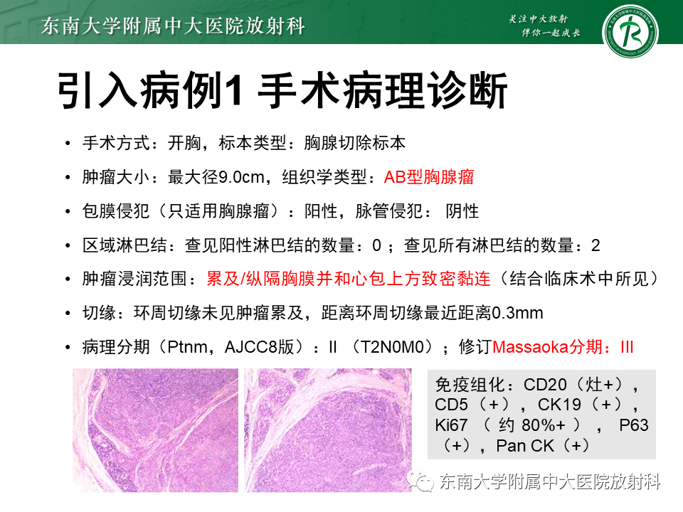 影像PPT - 【PPT】胸腺瘤-4 影像PPT - 【PPT】胸腺瘤-4
