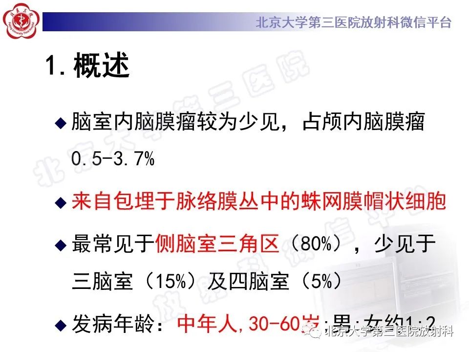 影像PPT - 【PPT】脑室内脑膜瘤-10