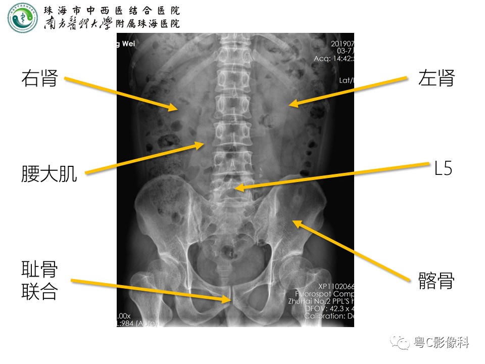 影像PPT - 【PPT】腹平片X线摄影及常见急腹症的诊断-8