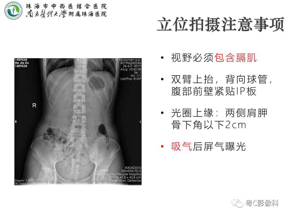 影像PPT - 【PPT】腹平片X线摄影及常见急腹症的诊断-4