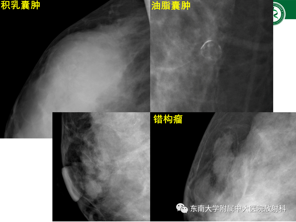 影像PPT - 【PPT】乳腺X线影像报告和数据系统（第五版）BI-RADS-6