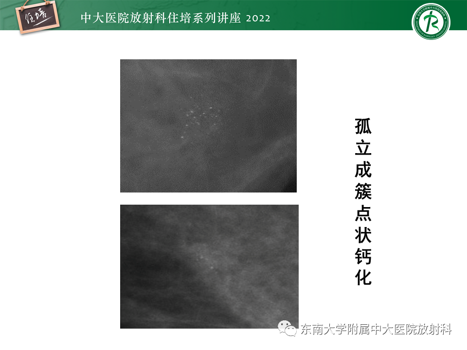 影像PPT - 【PPT】乳腺X线影像报告和数据系统（第五版）BI-RADS-15