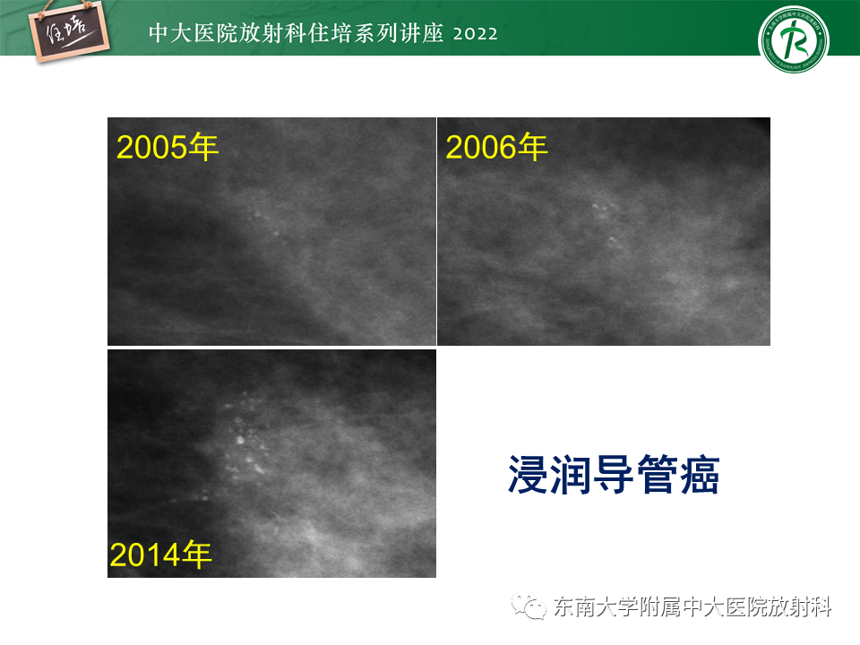 影像PPT - 【PPT】乳腺X线影像报告和数据系统（第五版）BI-RADS-27