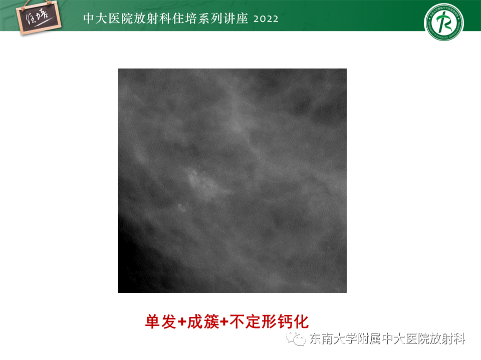 影像PPT - 【PPT】乳腺X线影像报告和数据系统（第五版）BI-RADS-28