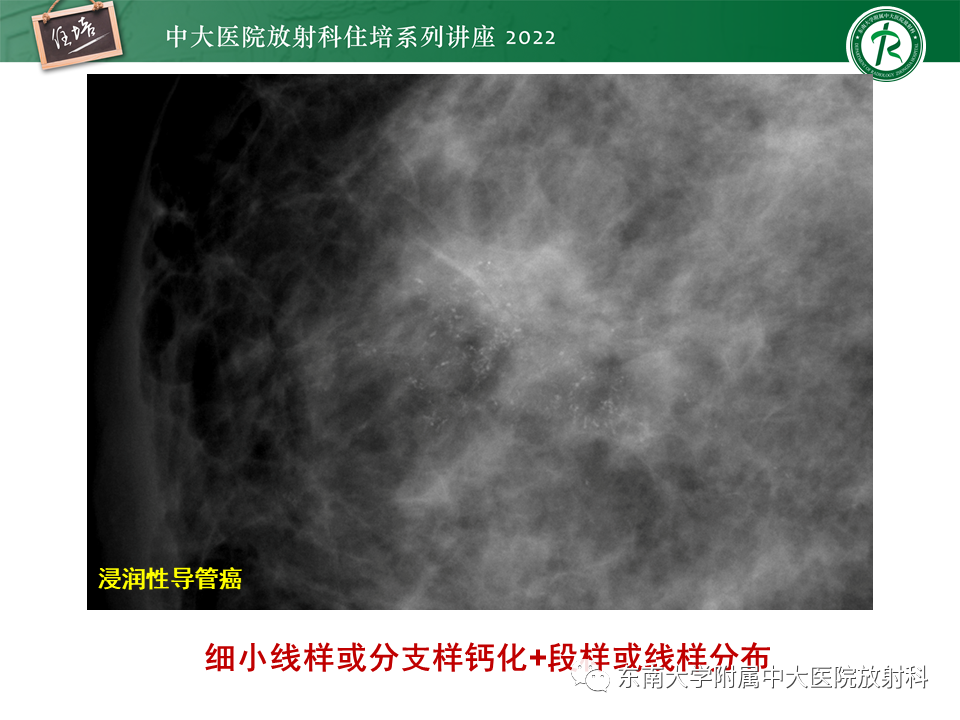 影像PPT - 【PPT】乳腺X线影像报告和数据系统（第五版）BI-RADS-36