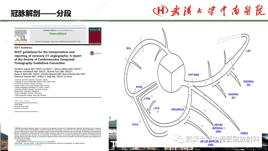 影像PPT - 【PPT】冠脉解剖与先天变异-10