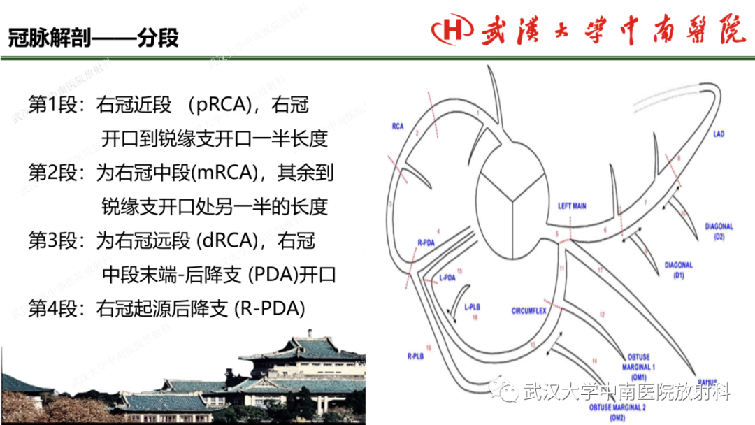 影像PPT - 【PPT】冠脉解剖与先天变异-11