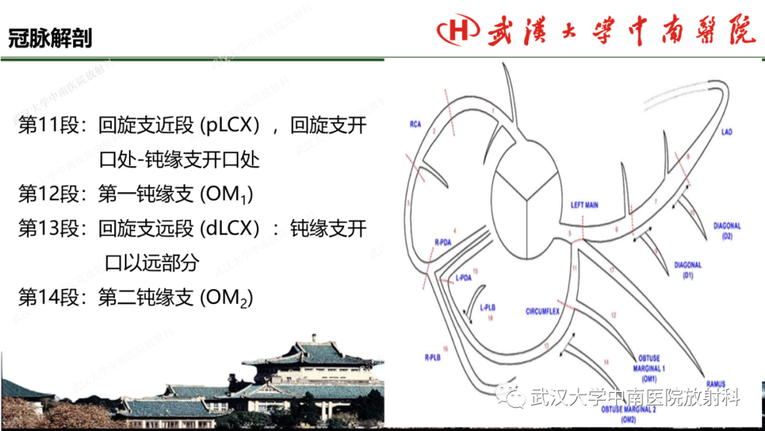 影像PPT - 【PPT】冠脉解剖与先天变异-13