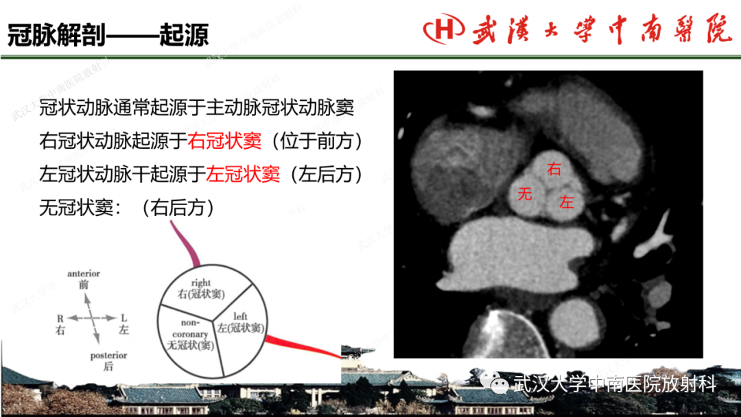 影像PPT - 【PPT】冠脉解剖与先天变异-2