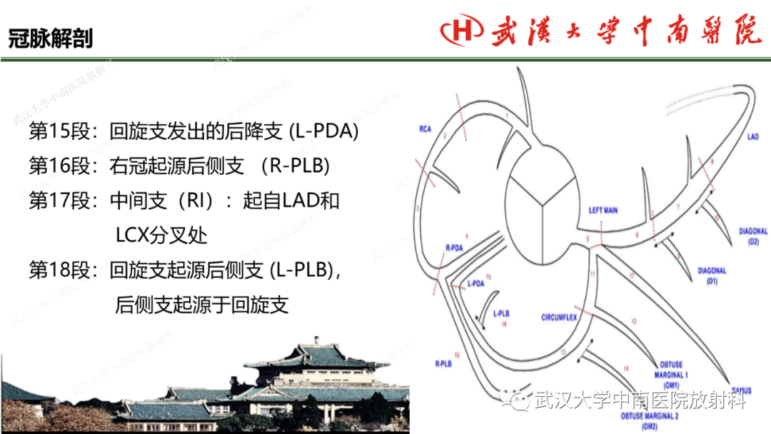 影像PPT - 【PPT】冠脉解剖与先天变异-14