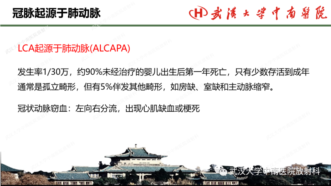 影像PPT - 【PPT】冠脉解剖与先天变异-35