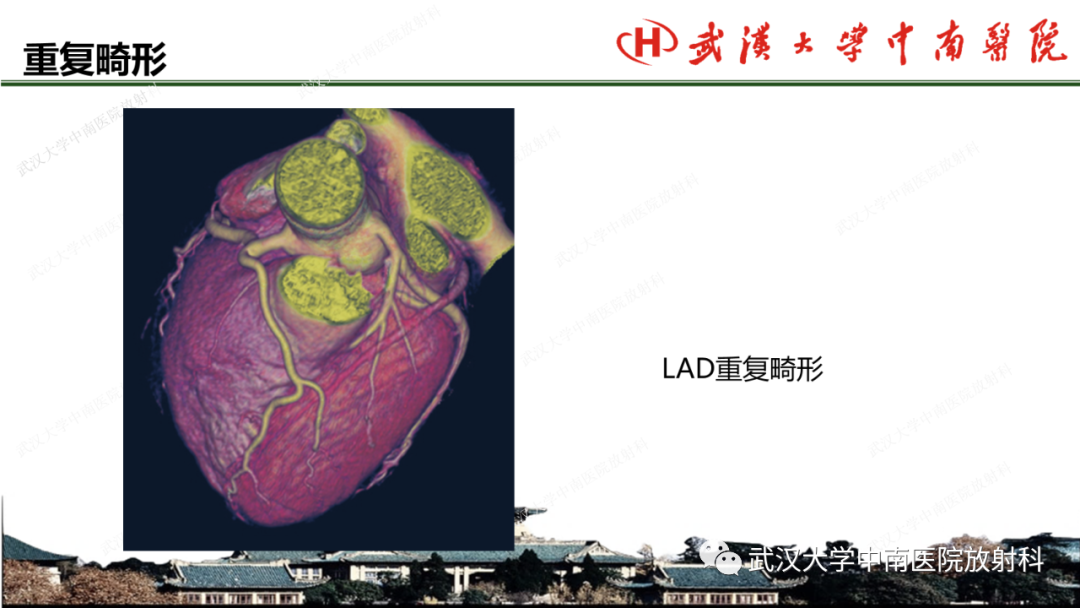 影像PPT - 【PPT】冠脉解剖与先天变异-41