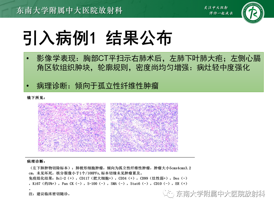 影像PPT - 【PPT】胸膜孤立性纤维瘤-2 影像PPT - 【PPT】胸膜孤立性纤维瘤-2