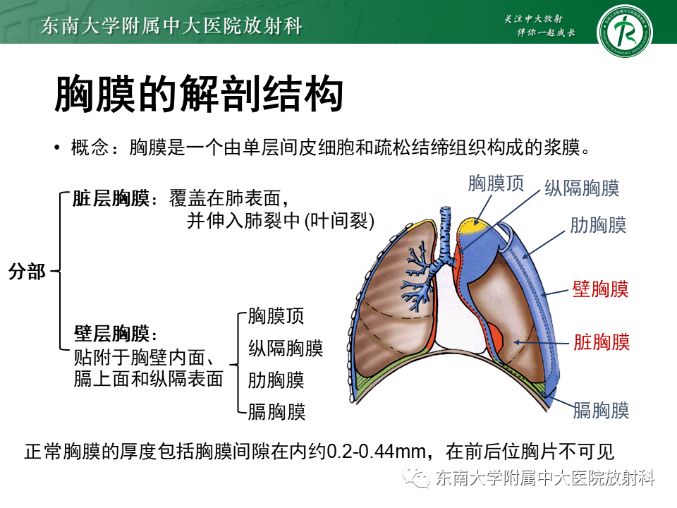 影像PPT - 【PPT】胸膜孤立性纤维瘤-5 影像PPT - 【PPT】胸膜孤立性纤维瘤-5