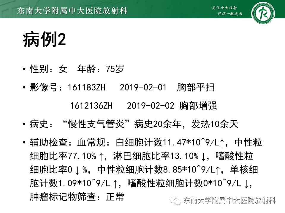 影像PPT - 【PPT】胸膜孤立性纤维瘤-17 影像PPT - 【PPT】胸膜孤立性纤维瘤-17