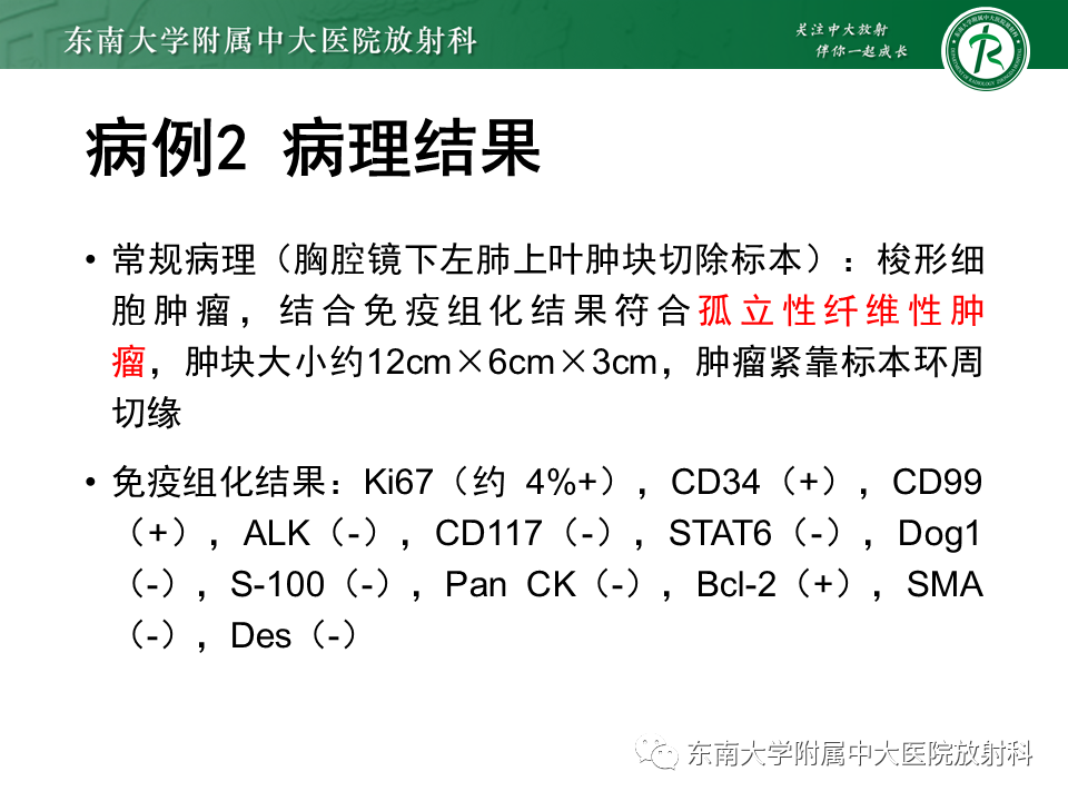影像PPT - 【PPT】胸膜孤立性纤维瘤-19 影像PPT - 【PPT】胸膜孤立性纤维瘤-19