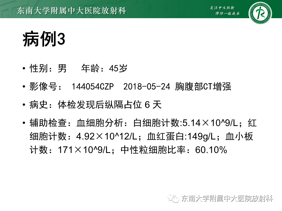 影像PPT - 【PPT】胸膜孤立性纤维瘤-22 影像PPT - 【PPT】胸膜孤立性纤维瘤-22