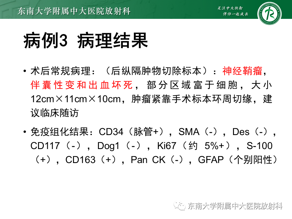 影像PPT - 【PPT】胸膜孤立性纤维瘤-24 影像PPT - 【PPT】胸膜孤立性纤维瘤-24