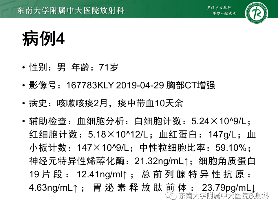 影像PPT - 【PPT】胸膜孤立性纤维瘤-26 影像PPT - 【PPT】胸膜孤立性纤维瘤-26