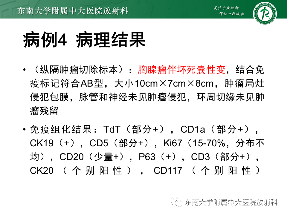 影像PPT - 【PPT】胸膜孤立性纤维瘤-28 影像PPT - 【PPT】胸膜孤立性纤维瘤-28
