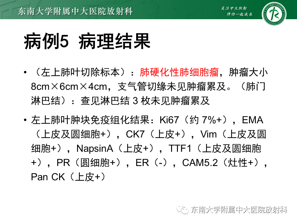 影像PPT - 【PPT】胸膜孤立性纤维瘤-33 影像PPT - 【PPT】胸膜孤立性纤维瘤-33