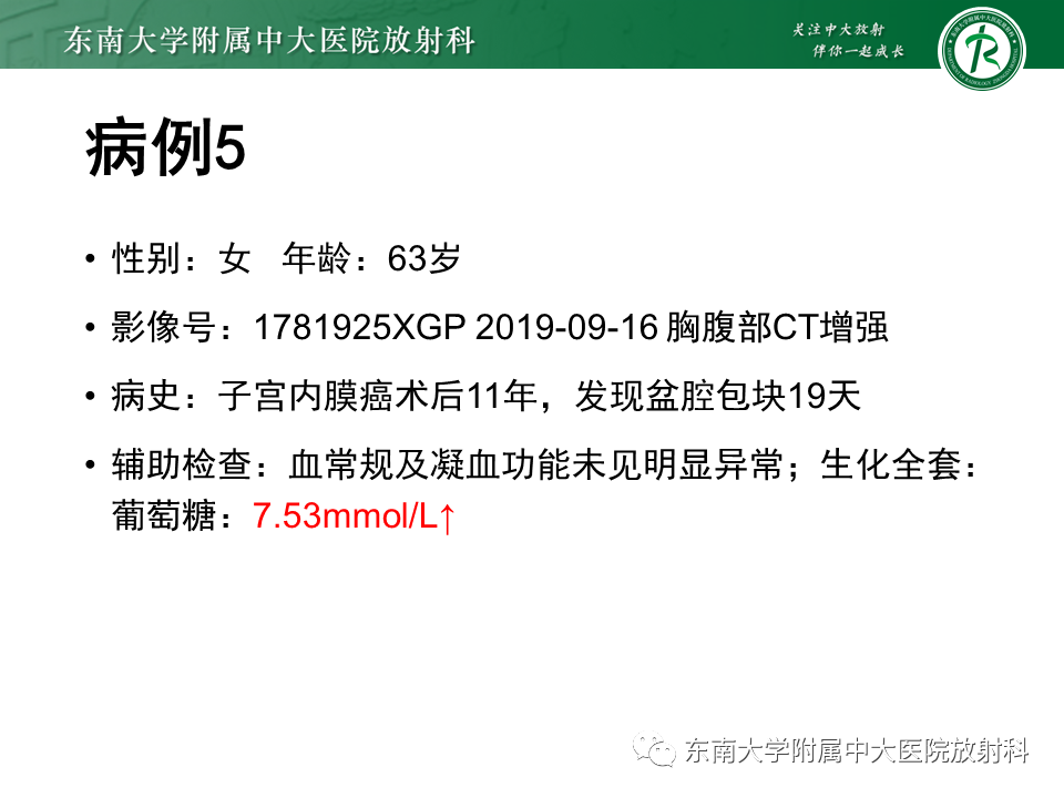 影像PPT - 【PPT】胸膜孤立性纤维瘤-31 影像PPT - 【PPT】胸膜孤立性纤维瘤-31