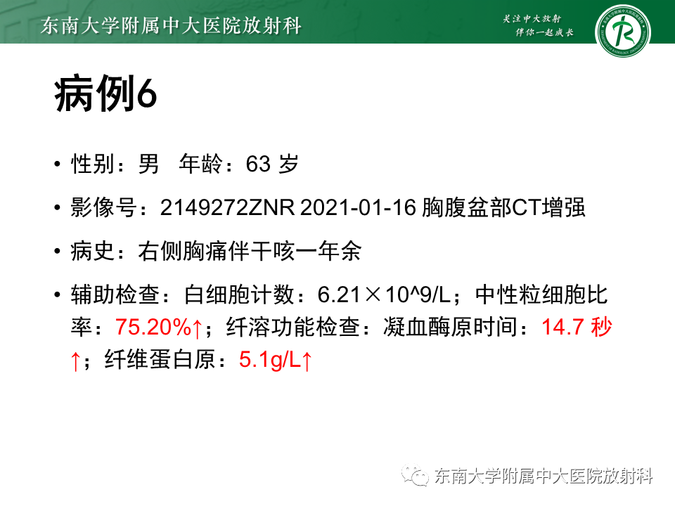 影像PPT - 【PPT】胸膜孤立性纤维瘤-35 影像PPT - 【PPT】胸膜孤立性纤维瘤-35