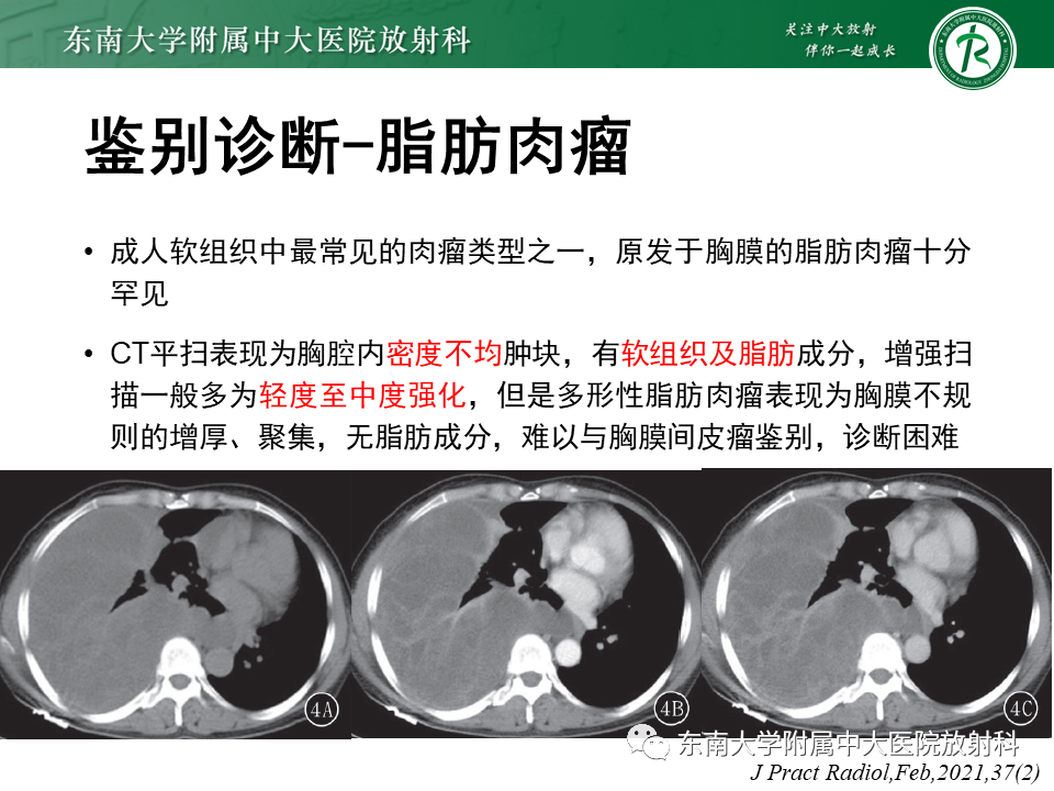 影像PPT - 【PPT】胸膜孤立性纤维瘤-40 影像PPT - 【PPT】胸膜孤立性纤维瘤-40