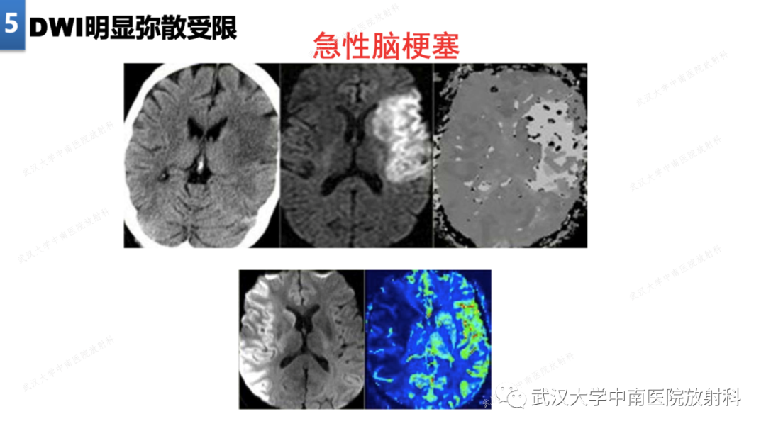影像PPT - 【PPT】局灶性脑部病变影像学诊断-41