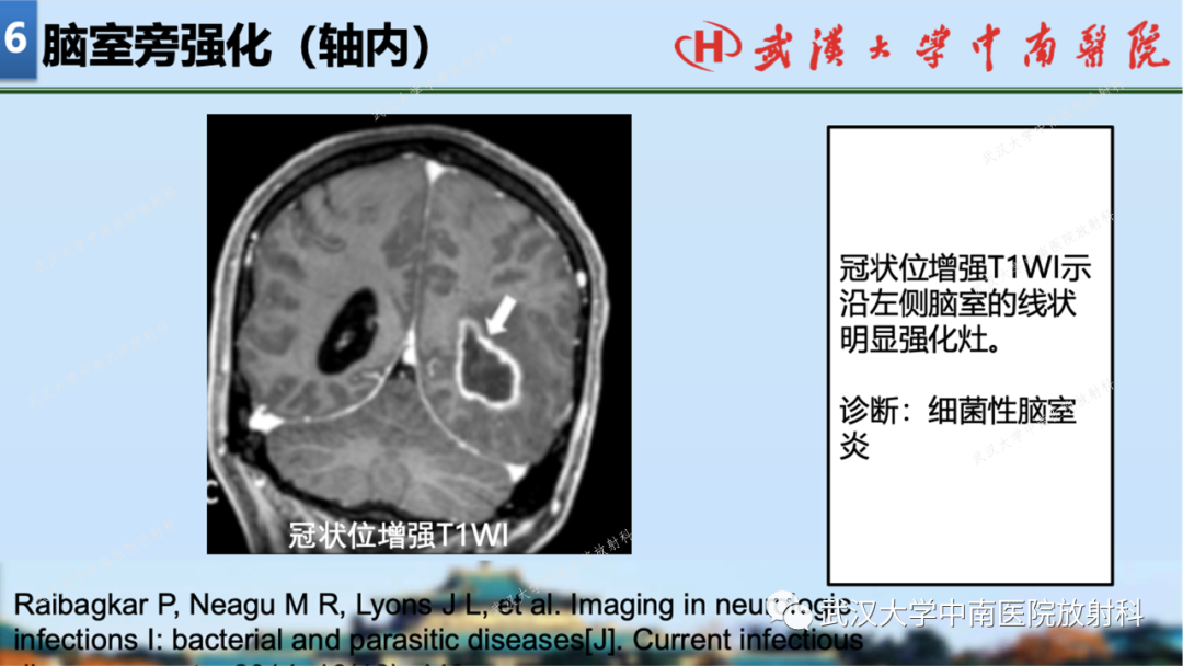 影像PPT - 【PPT】局灶性脑部病变影像学诊断-51
