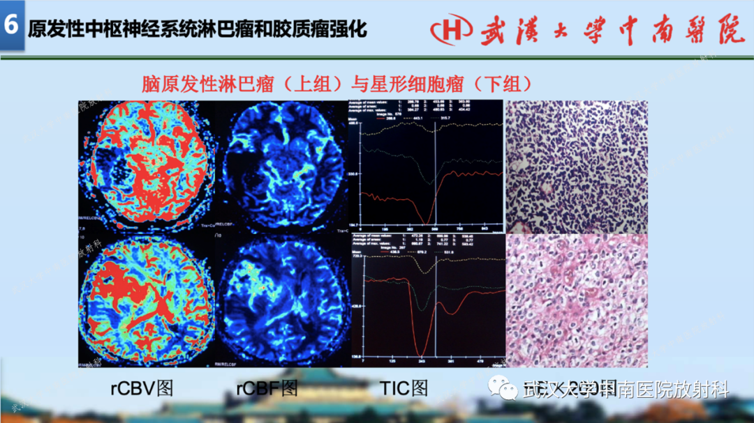 影像PPT - 【PPT】局灶性脑部病变影像学诊断-66