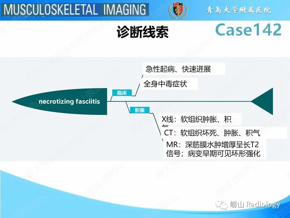 影像PPT - 【PPT】坏死性筋膜炎-24