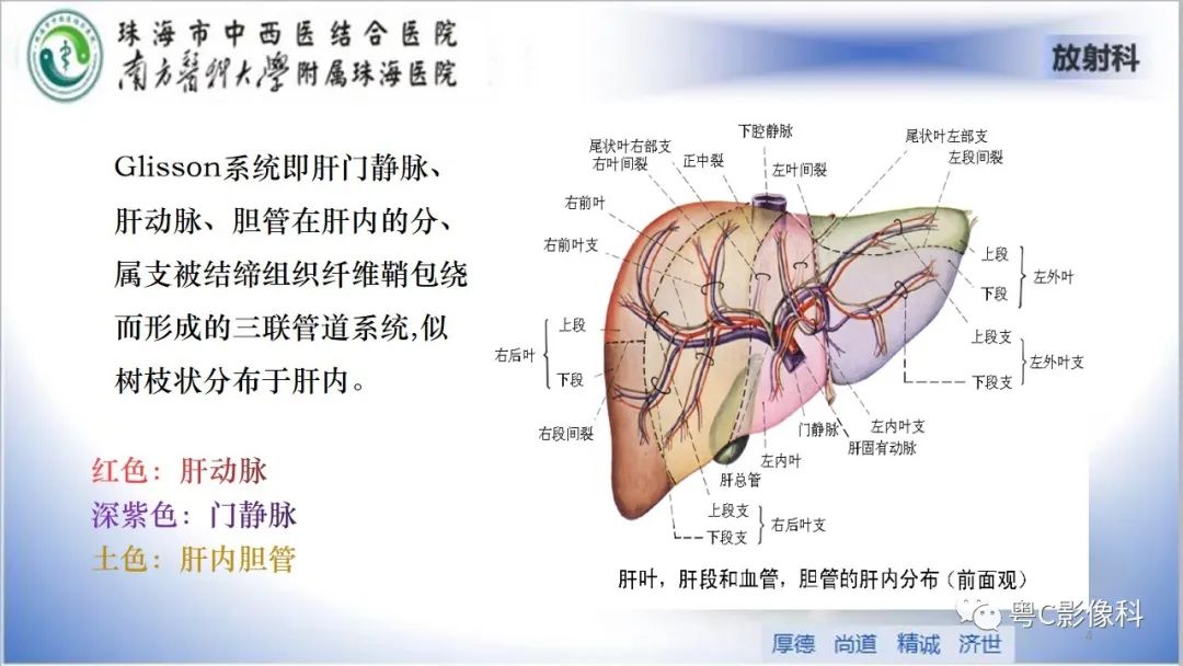影像PPT - 【PPT】肝脏影像分段及肝硬化结节MRI诊断-4