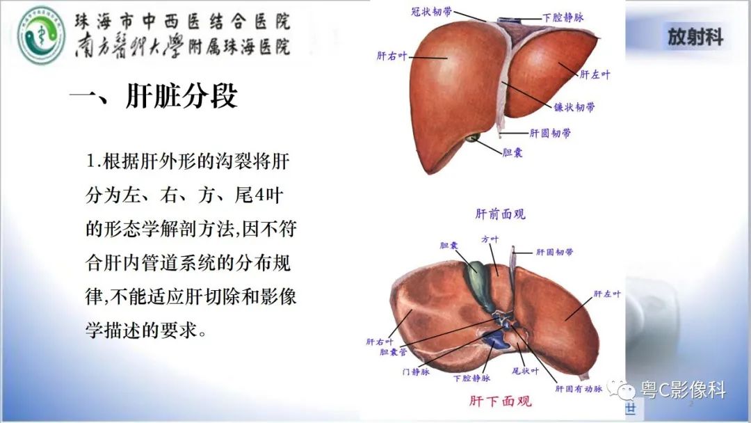 影像PPT - 【PPT】肝脏影像分段及肝硬化结节MRI诊断-2