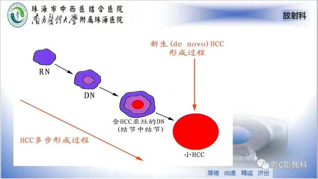 影像PPT - 【PPT】肝脏影像分段及肝硬化结节MRI诊断-12