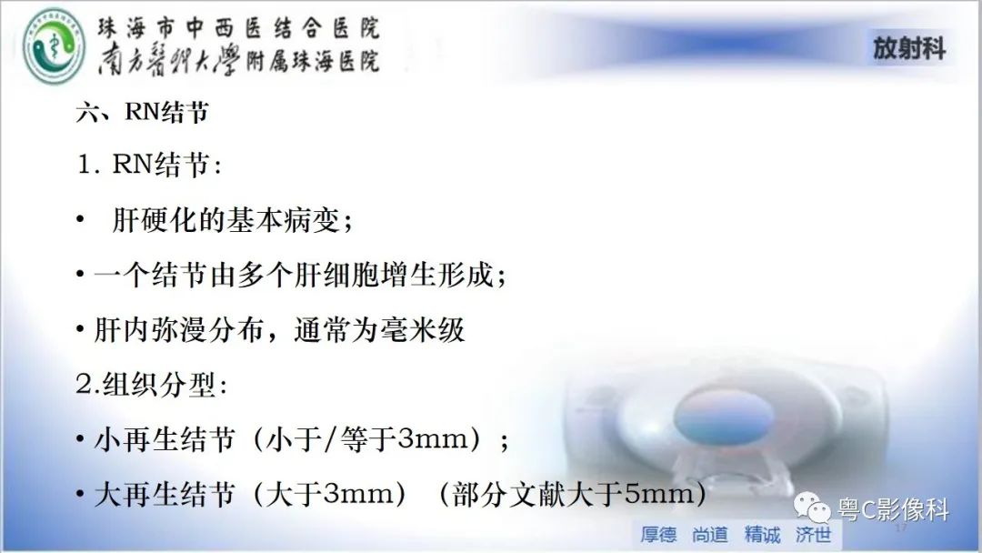 影像PPT - 【PPT】肝脏影像分段及肝硬化结节MRI诊断-17