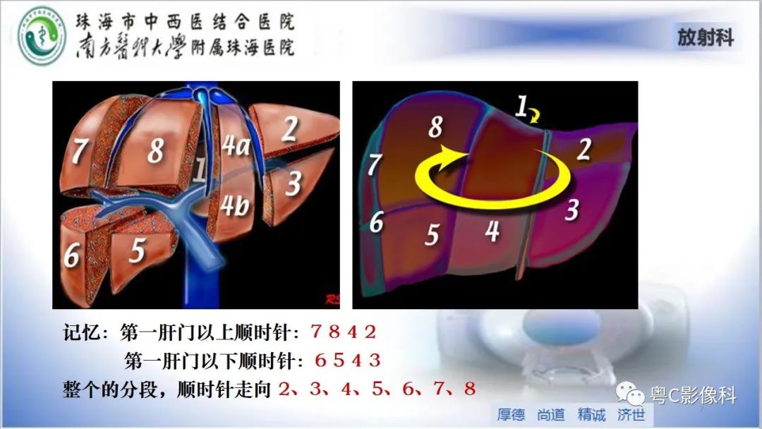 影像PPT - 【PPT】肝脏影像分段及肝硬化结节MRI诊断-7