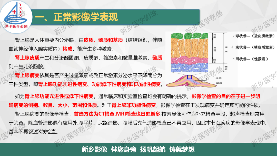 影像PPT - 【PPT】肾上腺解剖及常见疾病诊断要点-3
