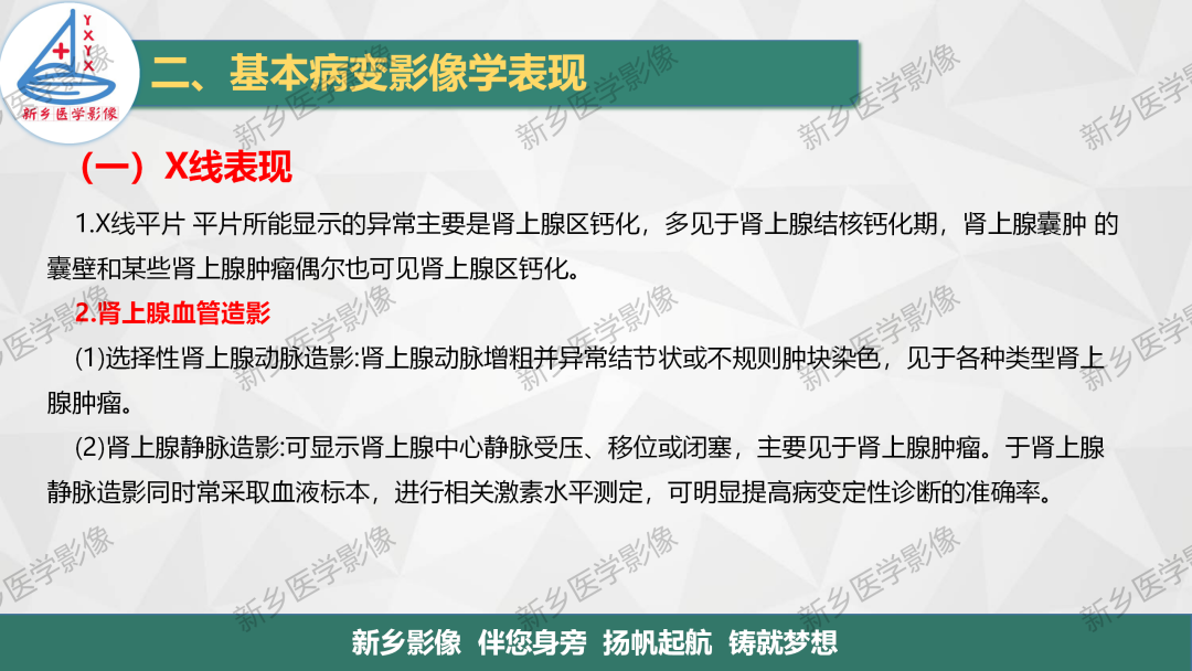 影像PPT - 【PPT】肾上腺解剖及常见疾病诊断要点-7