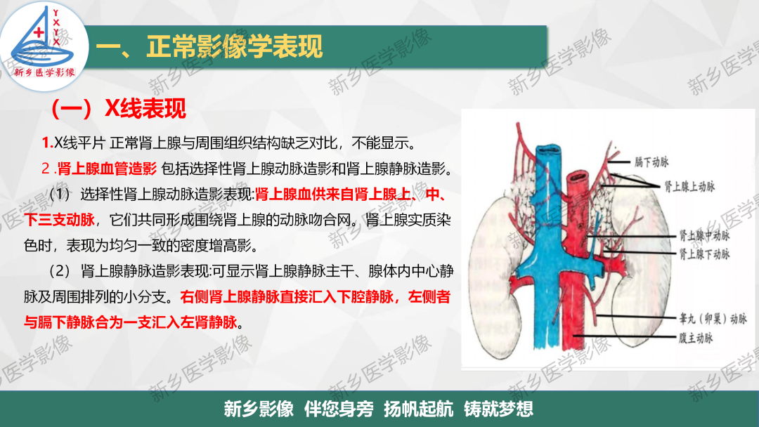 影像PPT - 【PPT】肾上腺解剖及常见疾病诊断要点-4