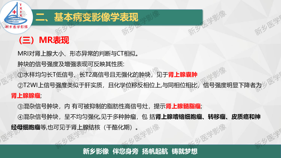 影像PPT - 【PPT】肾上腺解剖及常见疾病诊断要点-10