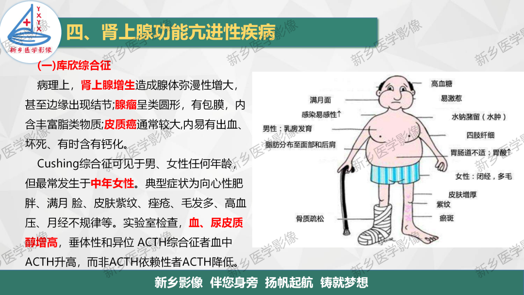 影像PPT - 【PPT】肾上腺解剖及常见疾病诊断要点-13