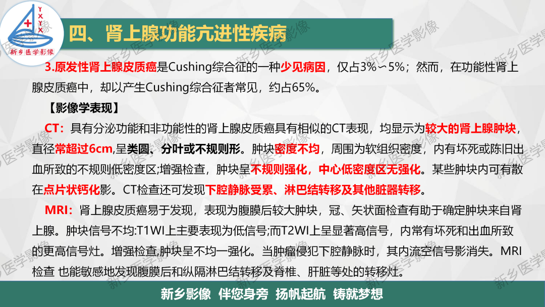 影像PPT - 【PPT】肾上腺解剖及常见疾病诊断要点-19