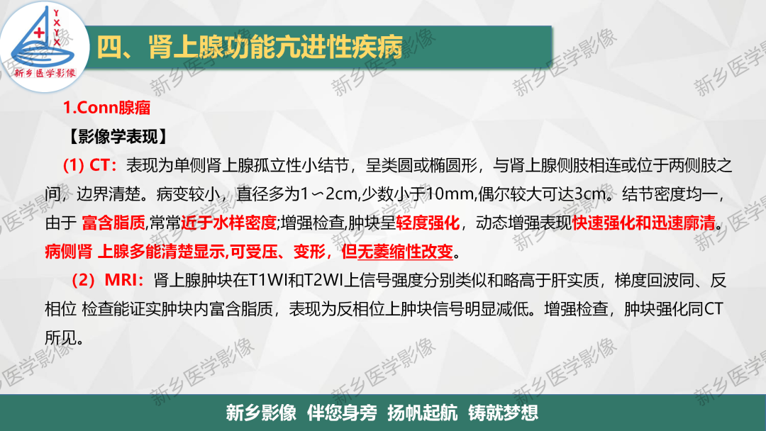 影像PPT - 【PPT】肾上腺解剖及常见疾病诊断要点-24