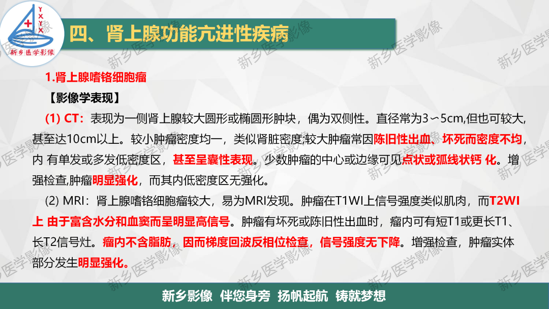 影像PPT - 【PPT】肾上腺解剖及常见疾病诊断要点-30
