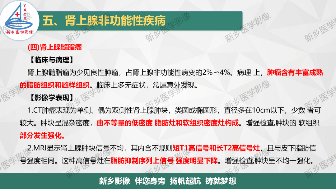 影像PPT - 【PPT】肾上腺解剖及常见疾病诊断要点-44